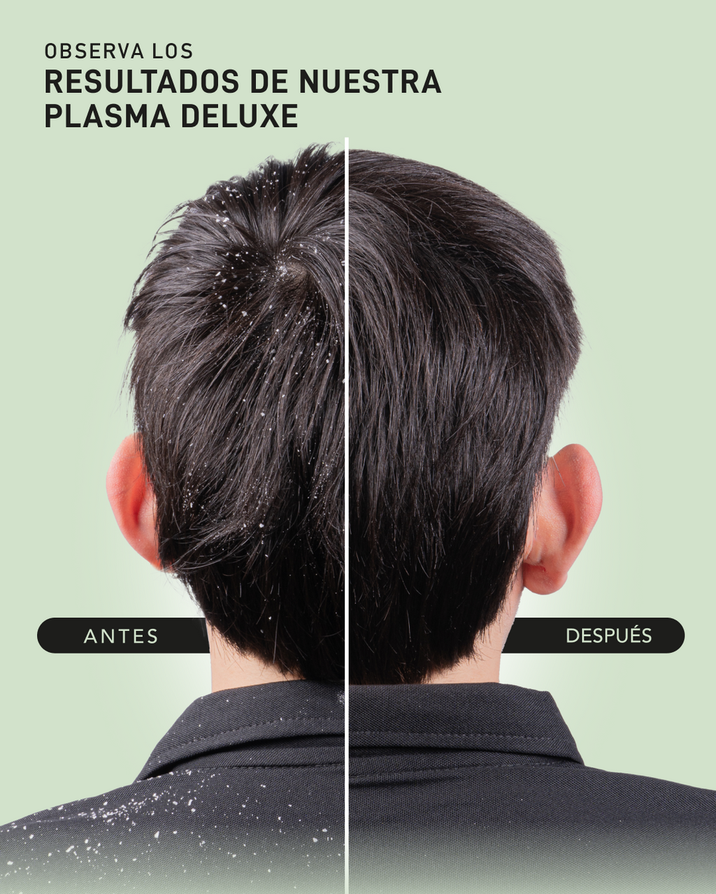 KIT PLASMA EQUILIBRIO ANTICASPA